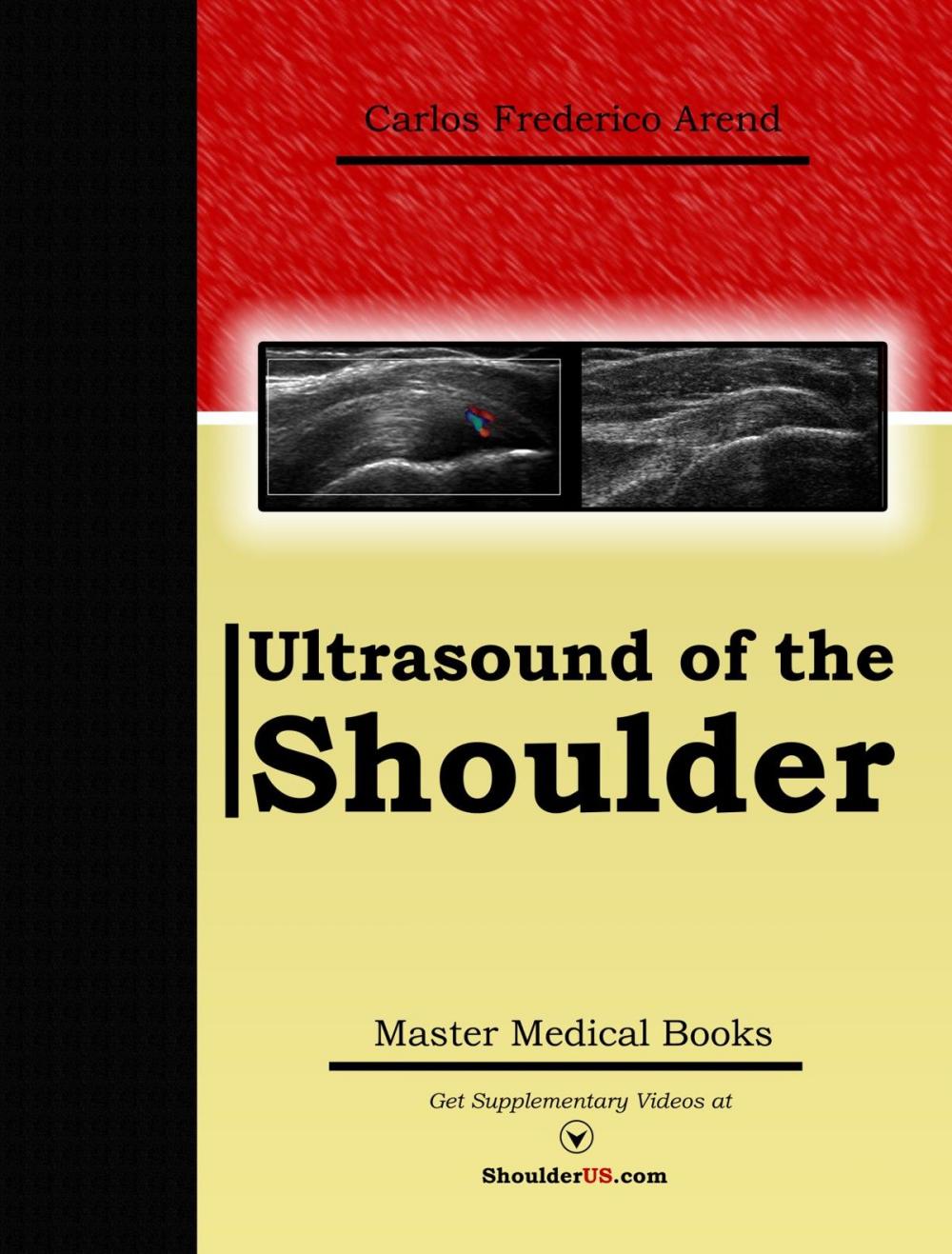 Big bigCover of Ultrasound of the Shoulder