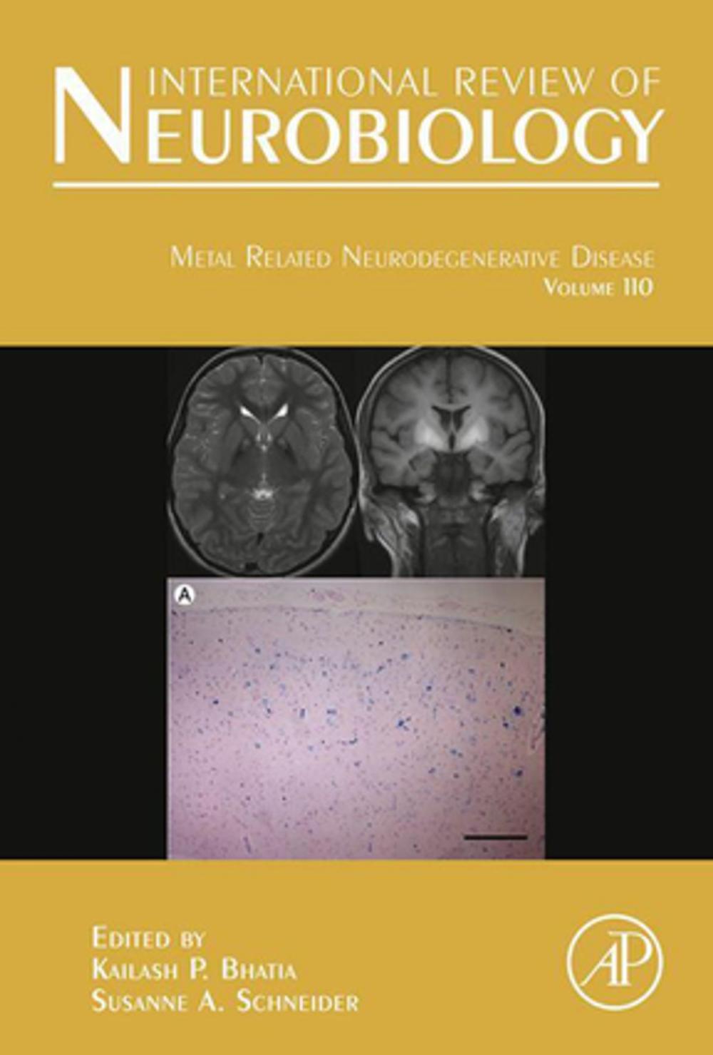 Big bigCover of Metal Related Neurodegenerative Disease