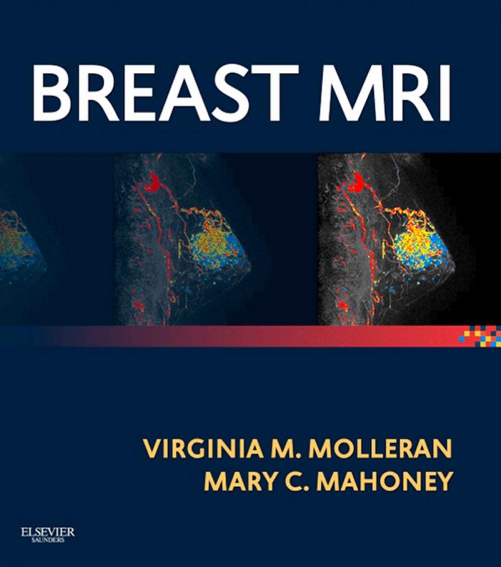 Big bigCover of Breast MRI E-Book