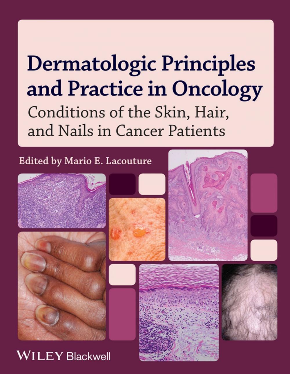 Big bigCover of Dermatologic Principles and Practice in Oncology