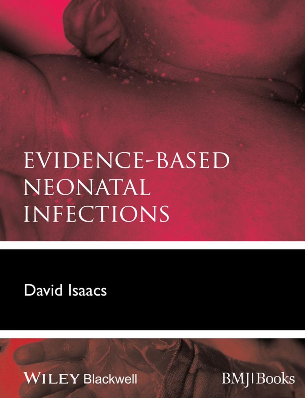 Big bigCover of Evidence-Based Neonatal Infections