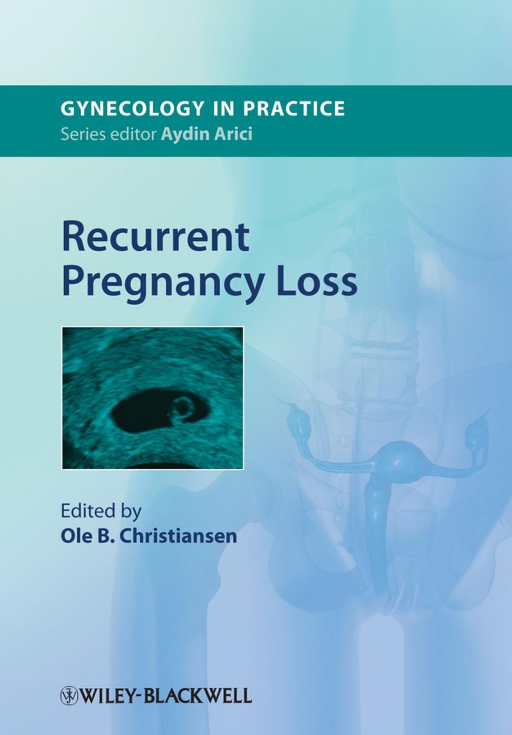 Big bigCover of Recurrent Pregnancy Loss