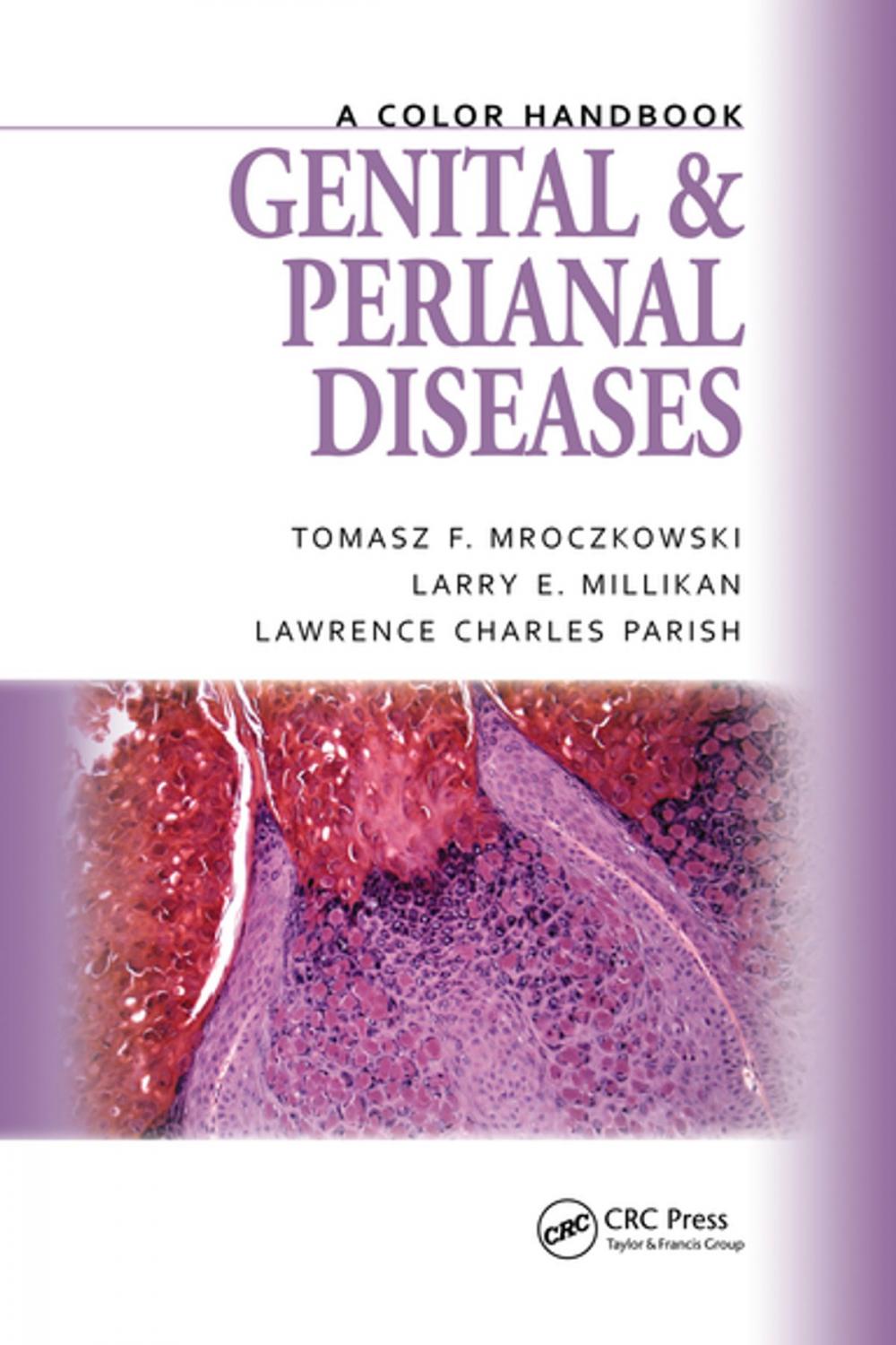 Big bigCover of Genital and Perianal Diseases