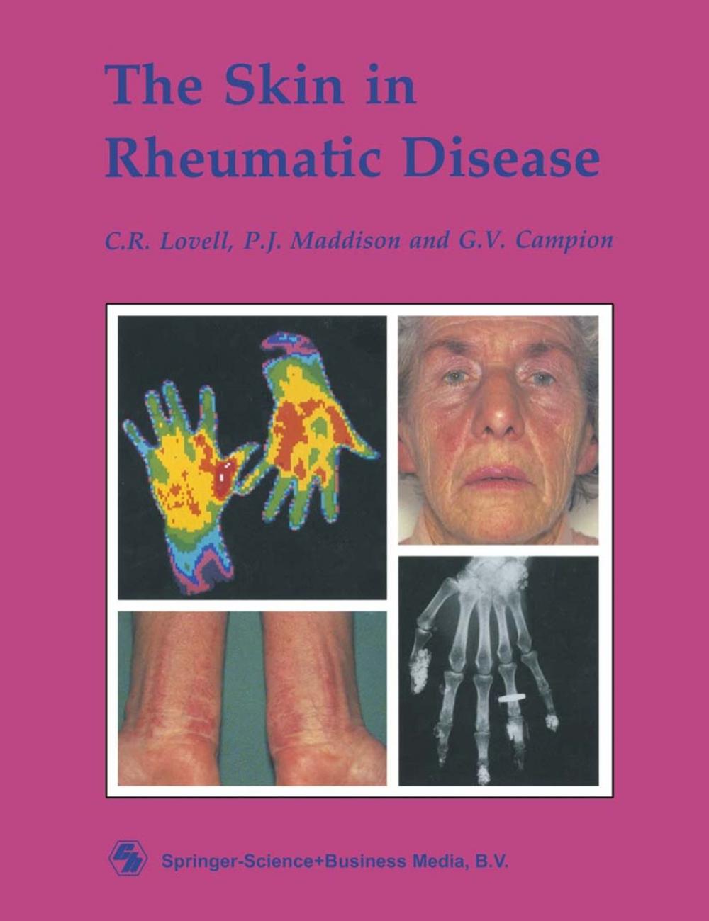 Big bigCover of The Skin in Rheumatic Disease