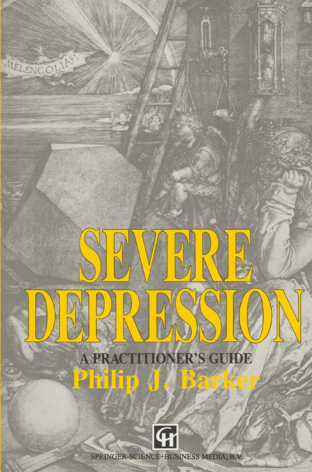 Big bigCover of Severe Depression