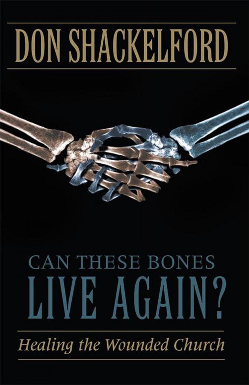 Big bigCover of Can These Bones Live Again?