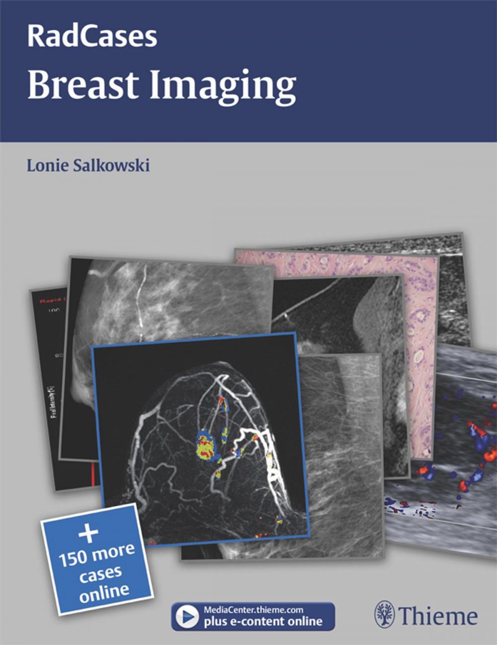 Big bigCover of Breast Imaging