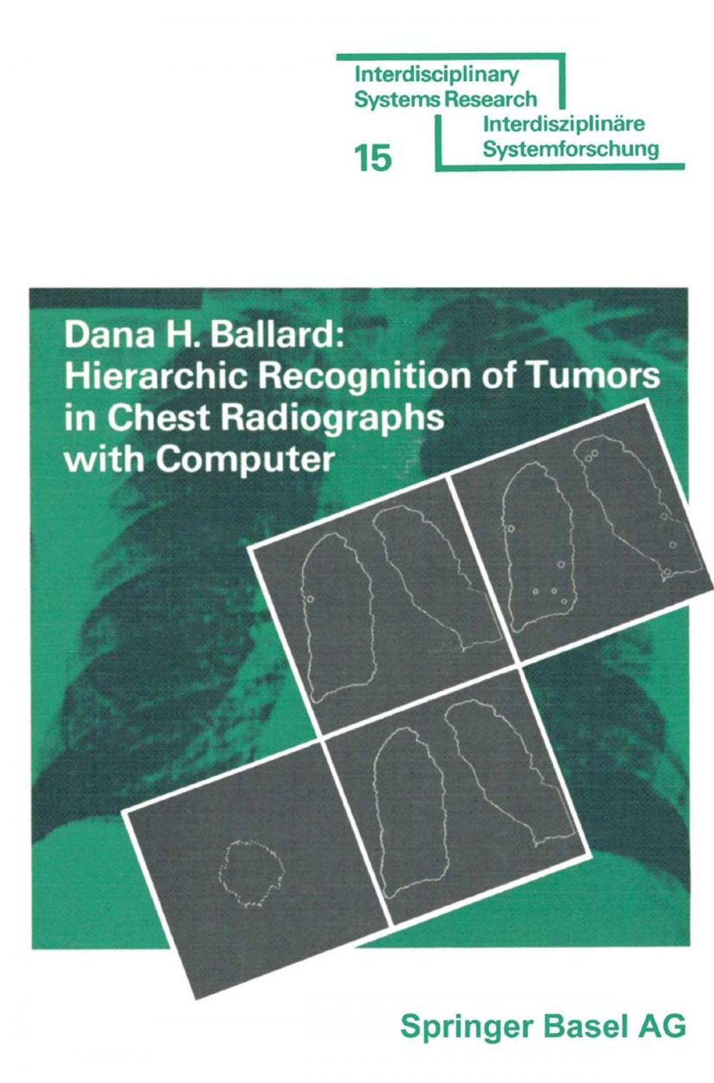 Big bigCover of Hierarchic Recognition of Tumors in Chest Radiographs with Computer