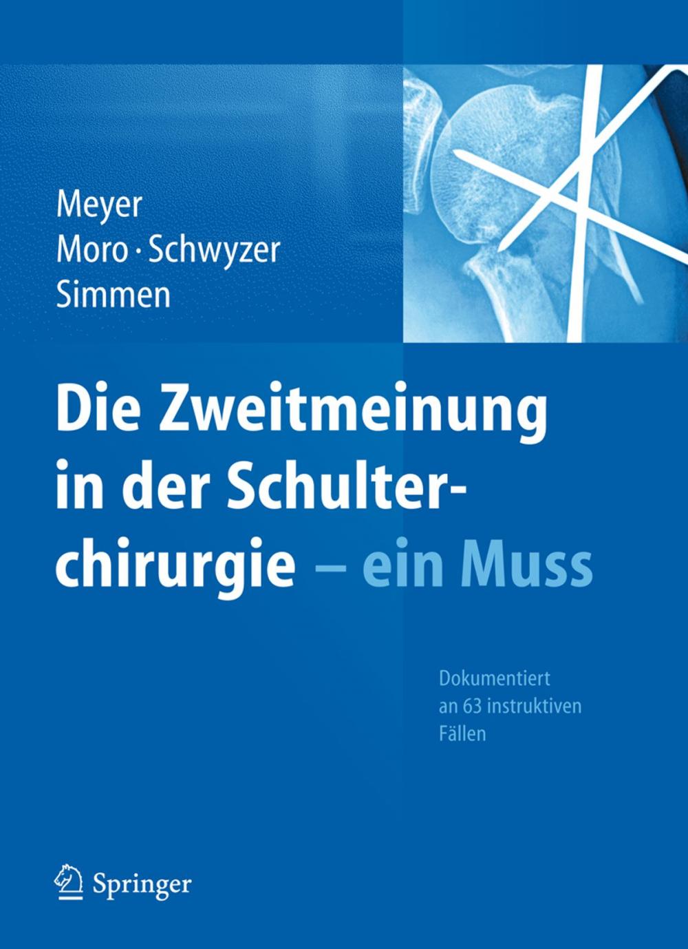 Big bigCover of Die Zweitmeinung in der Schulterchirurgie - ein Muss