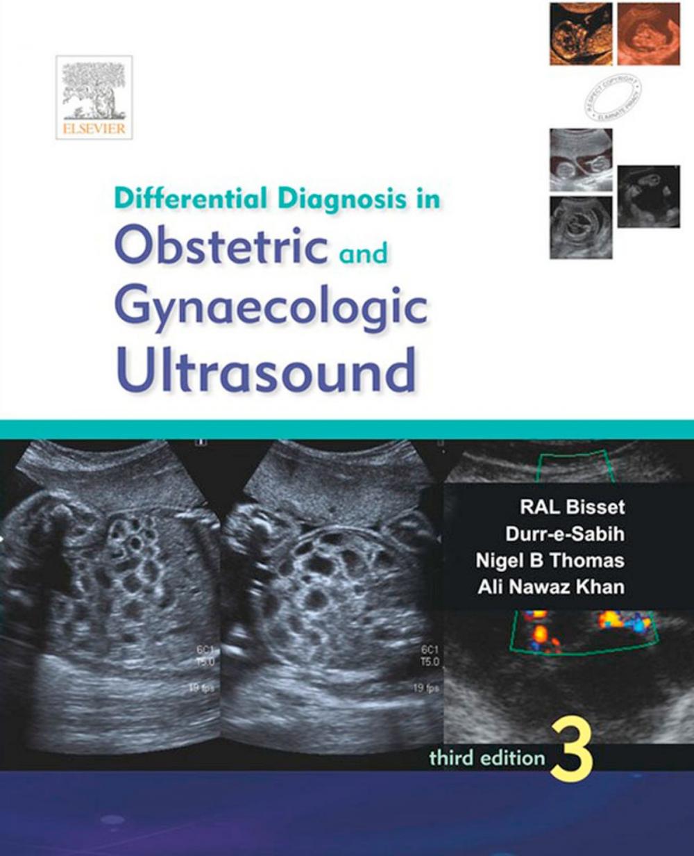 Big bigCover of Differential Diagnosis in Obstetrics and Gynecologic Ultrasound - E-Book