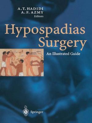 Cover of the book Hypospadias Surgery by H.G. Hansen, E. Graucob
