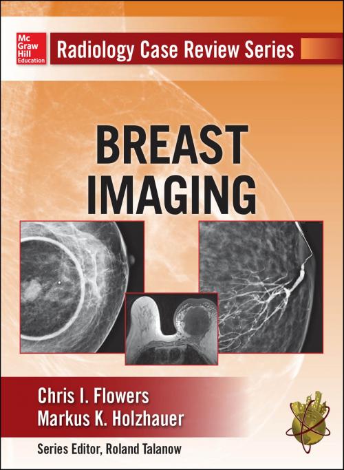 Cover of the book Radioliogy Case Review Series: Breast Imaging by Chris Flowers, Markus Holzhauer, Mcgraw-hill