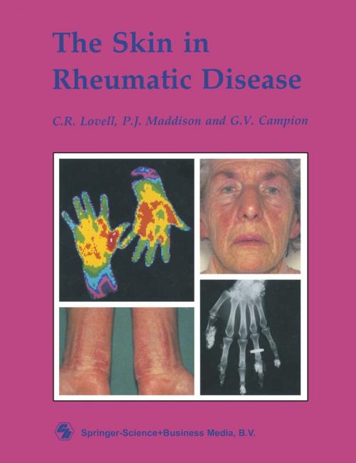 Cover of the book The Skin in Rheumatic Disease by C. R. Lovell, G. V. Campion, P. J. Maddison, Springer US