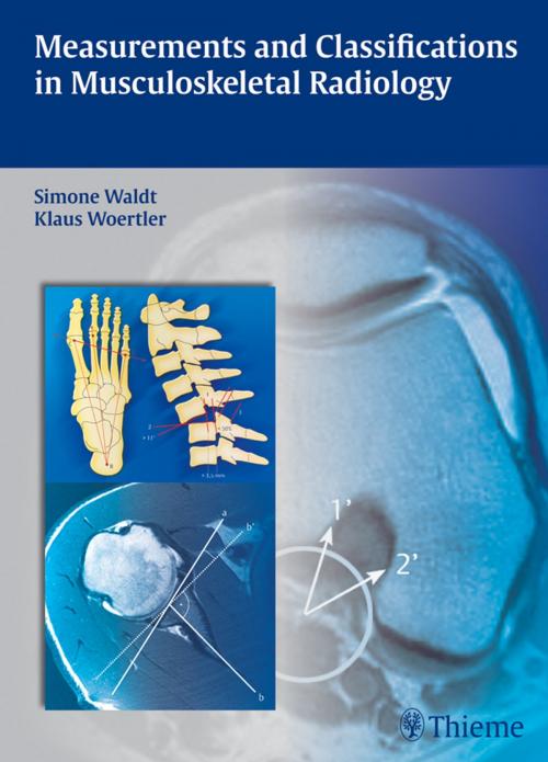 Cover of the book Measurements and Classifications in Musculoskeletal Radiology by Simone Waldt, Matthias Eiber, Klaus Woertler, Thieme