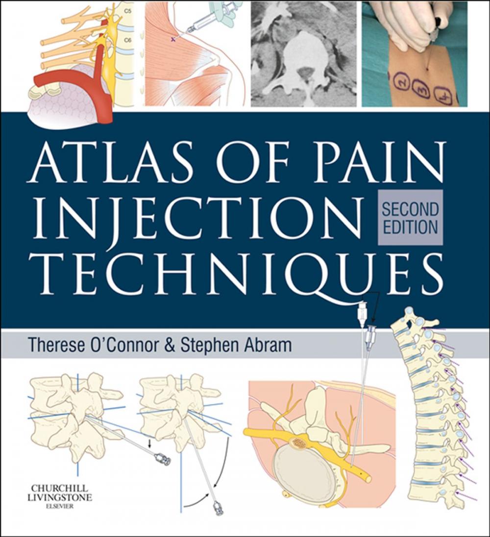 Big bigCover of Atlas of Pain Injection Techniques E-Book