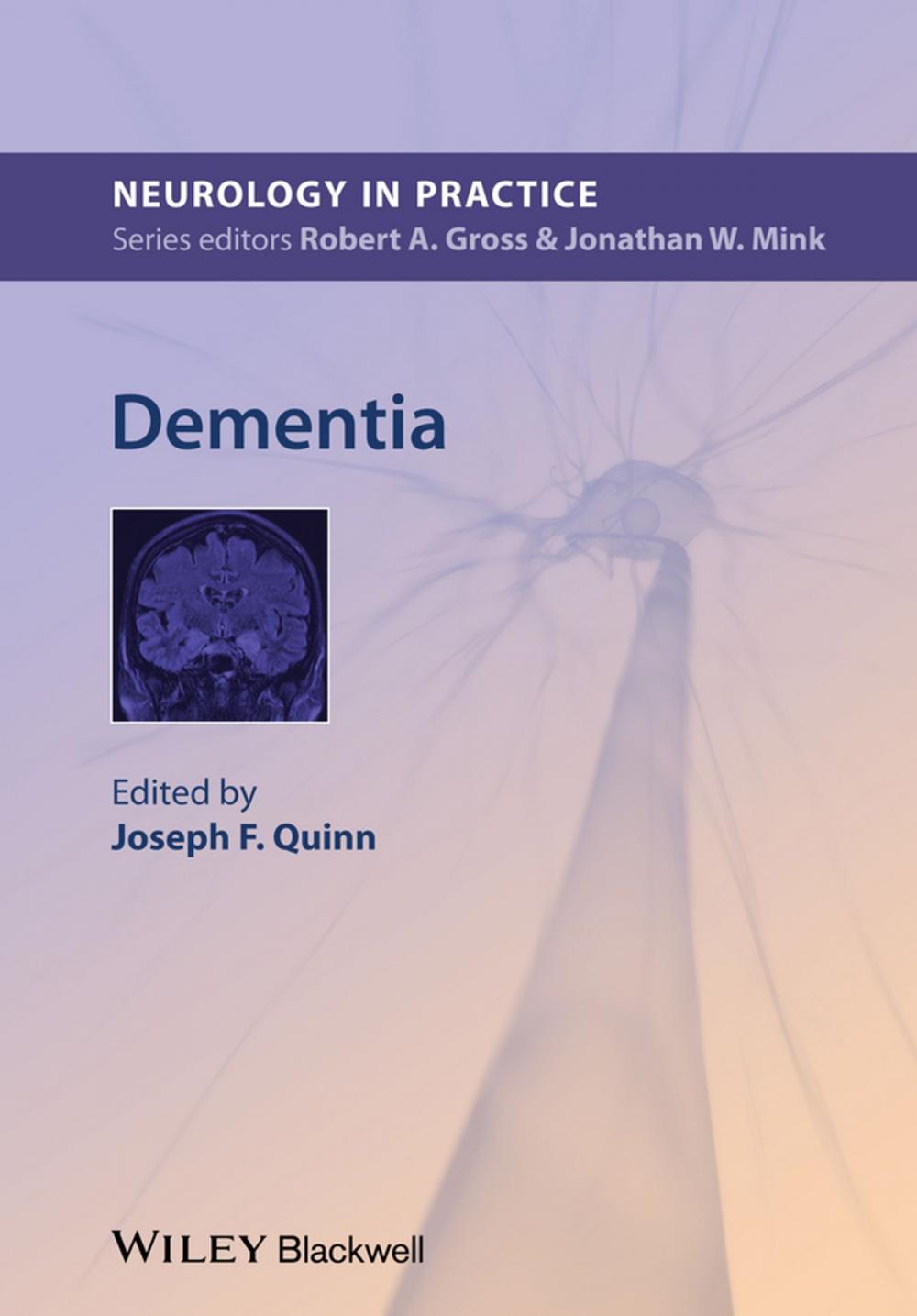 Big bigCover of Dementia