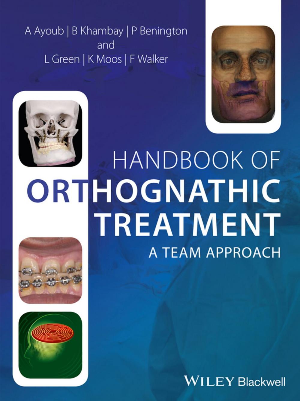 Big bigCover of Handbook of Orthognathic Treatment