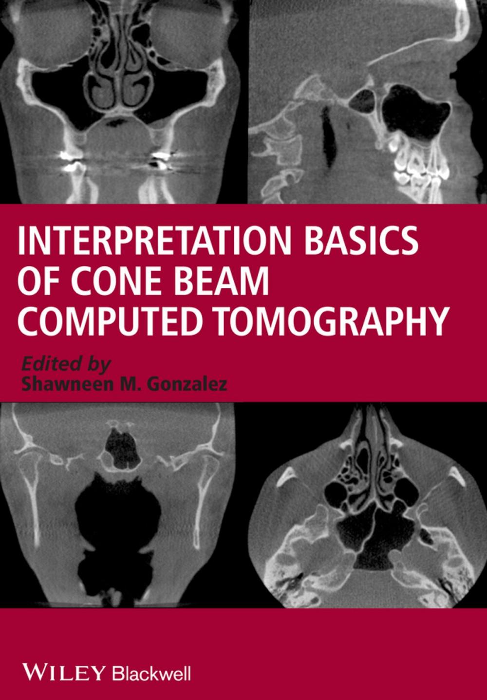 Big bigCover of Interpretation Basics of Cone Beam Computed Tomography