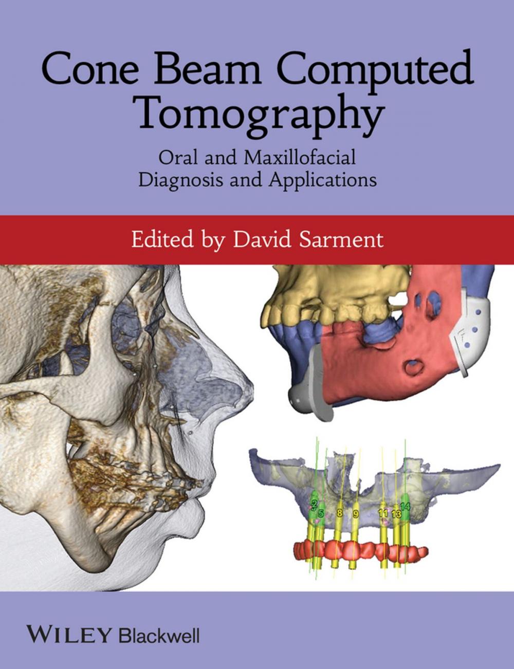 Big bigCover of Cone Beam Computed Tomography