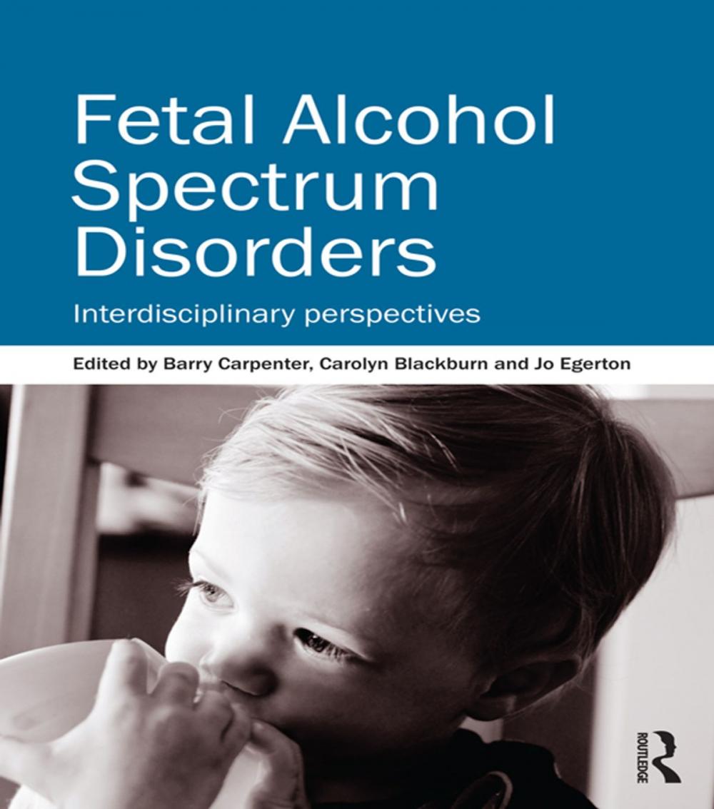 Big bigCover of Fetal Alcohol Spectrum Disorders