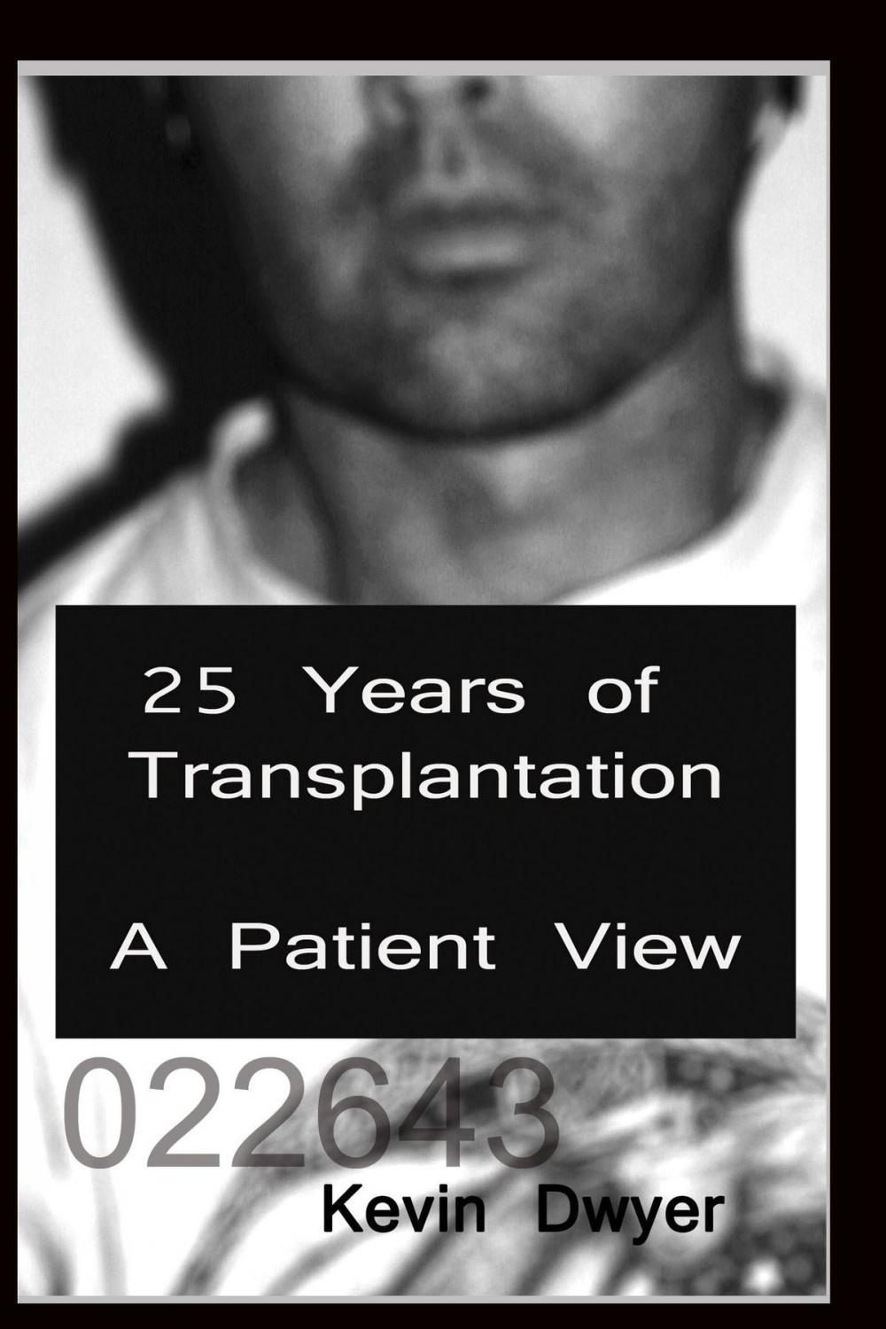 Big bigCover of 25 Years of Transplantation: A Patient View