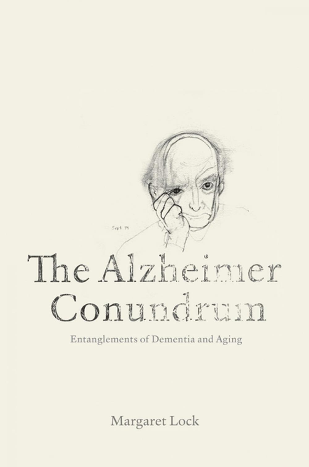 Big bigCover of The Alzheimer Conundrum