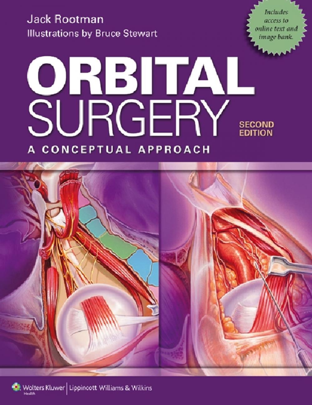 Big bigCover of Orbital Surgery