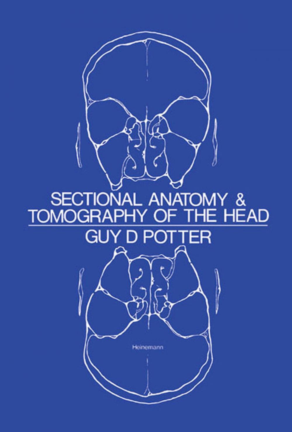 Big bigCover of Sectional Anatomy and Tomography of the Head