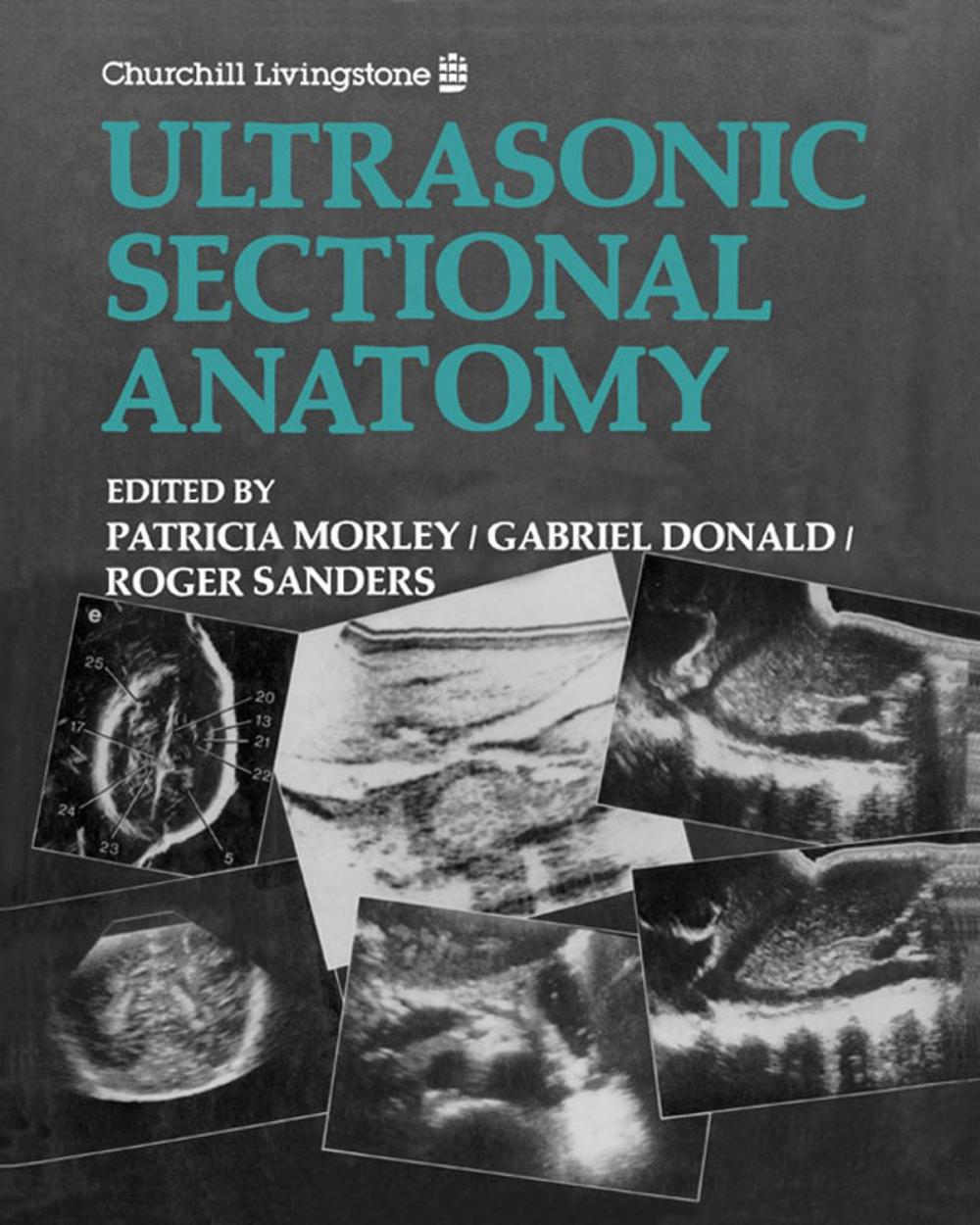 Big bigCover of Ultrasonic Sectional Anatomy