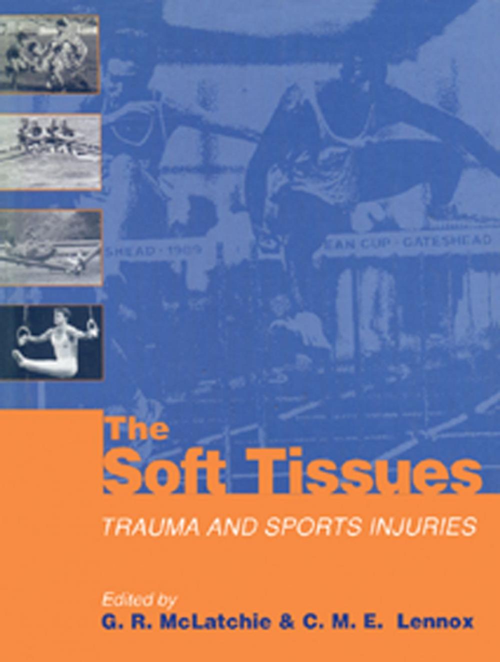 Big bigCover of The Soft Tissues