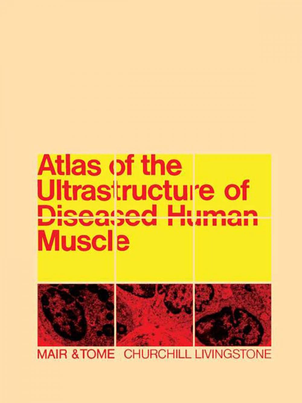 Big bigCover of Atlas of the Ultrastructure of Diseased Human Muscle