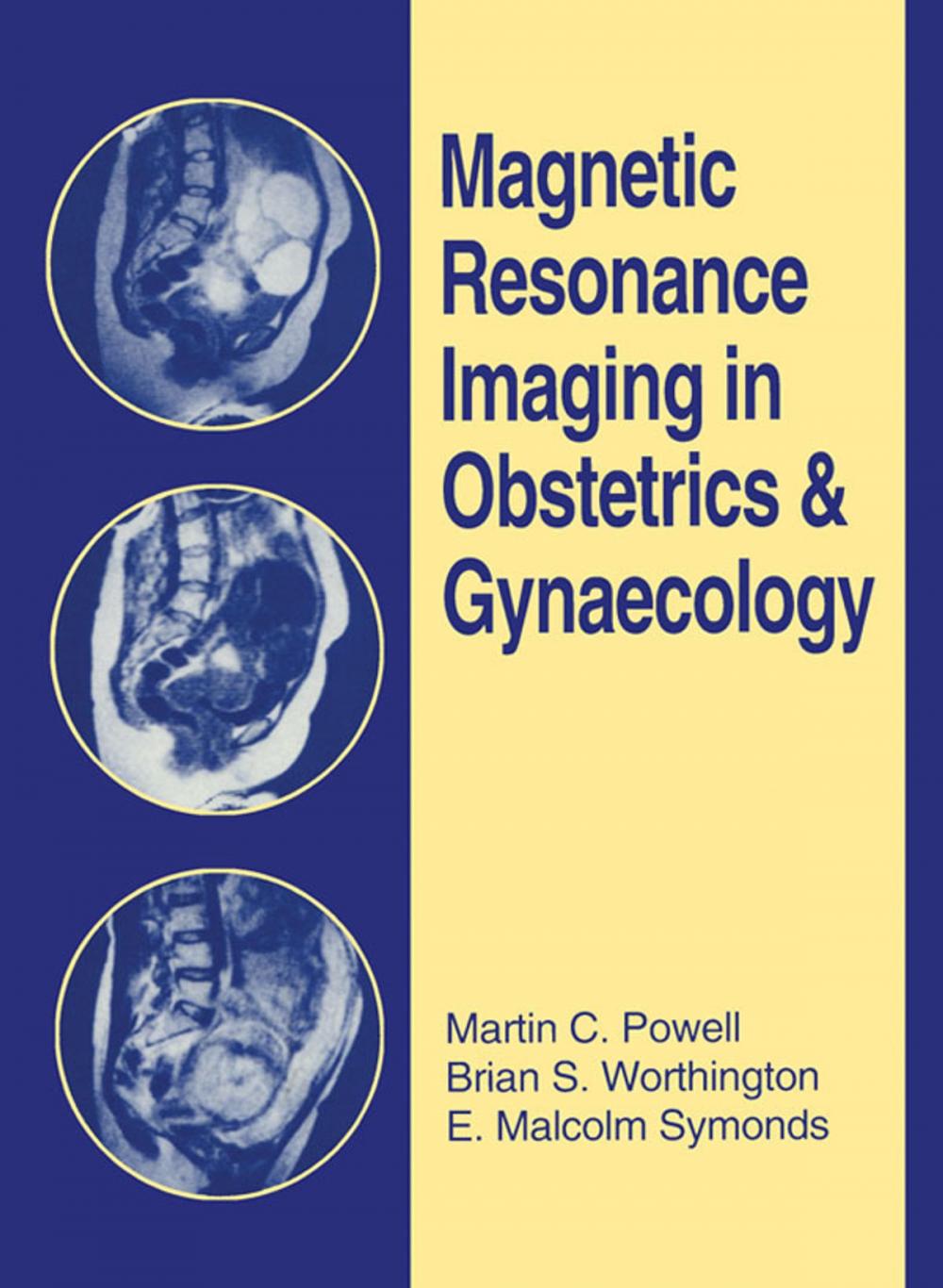 Big bigCover of Magnetic Resonance Imaging in Obstetrics and Gynaecology