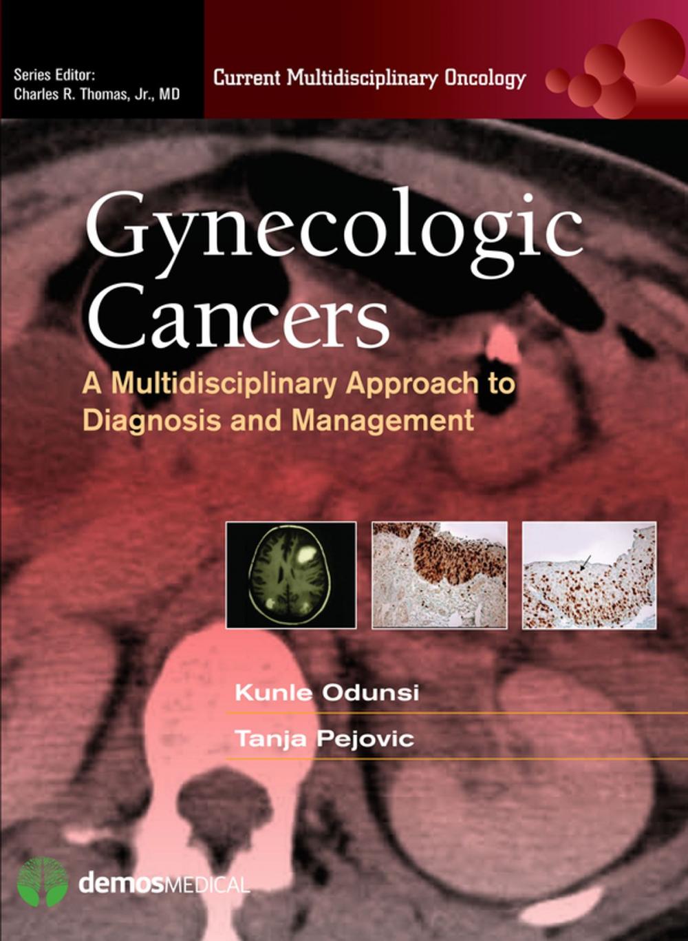 Big bigCover of Gynecologic Cancers