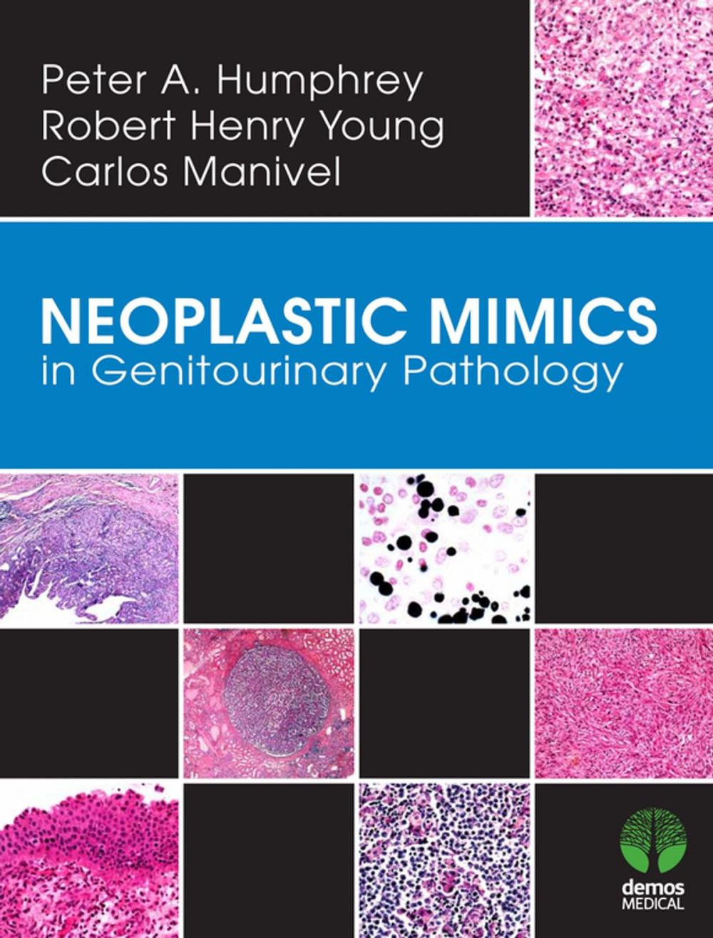 Big bigCover of Neoplastic Mimics in Genitourinary Pathology