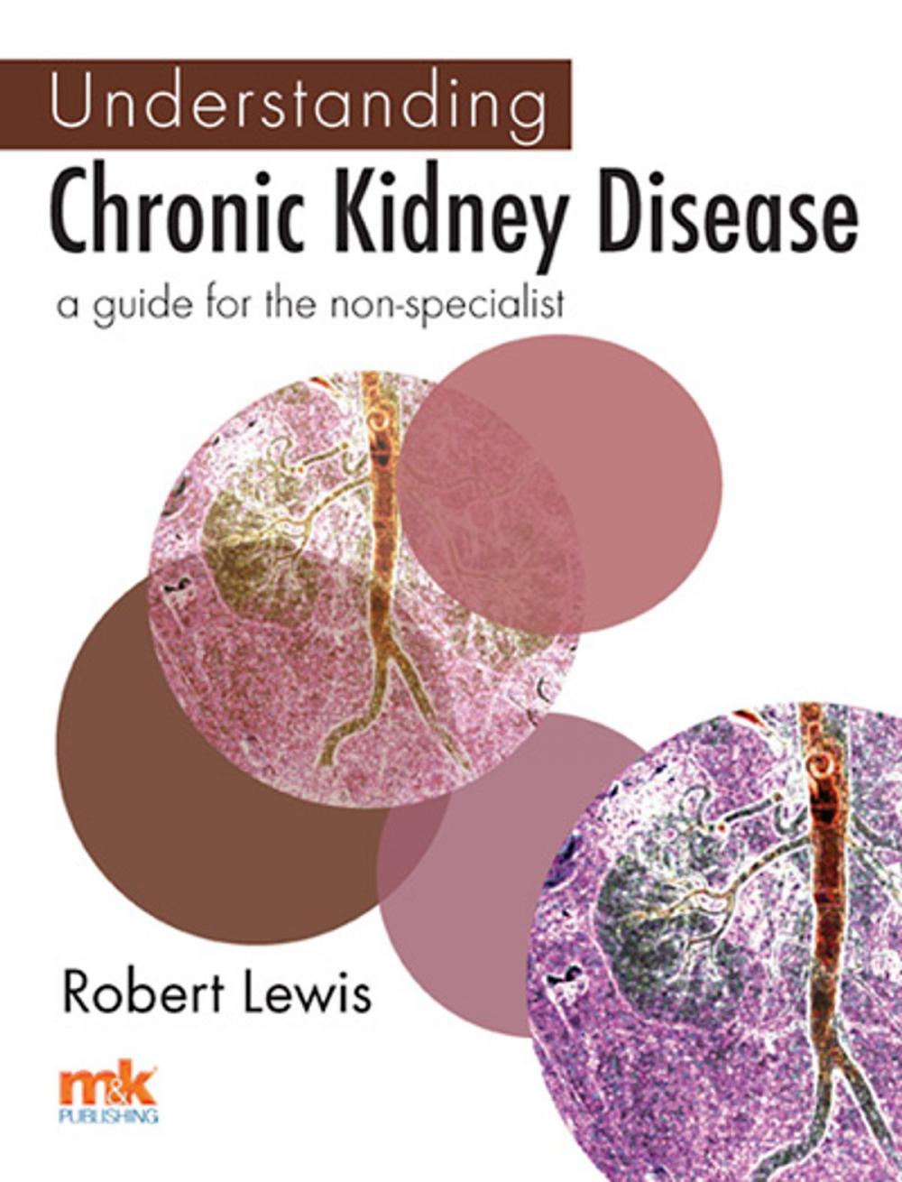 Big bigCover of Understanding Chronic Kidney Disease: A guide for the non-specialist