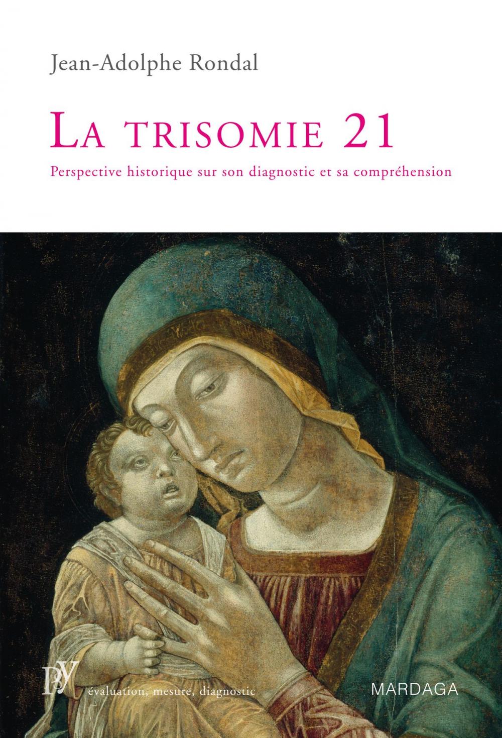 Big bigCover of La trisomie 21