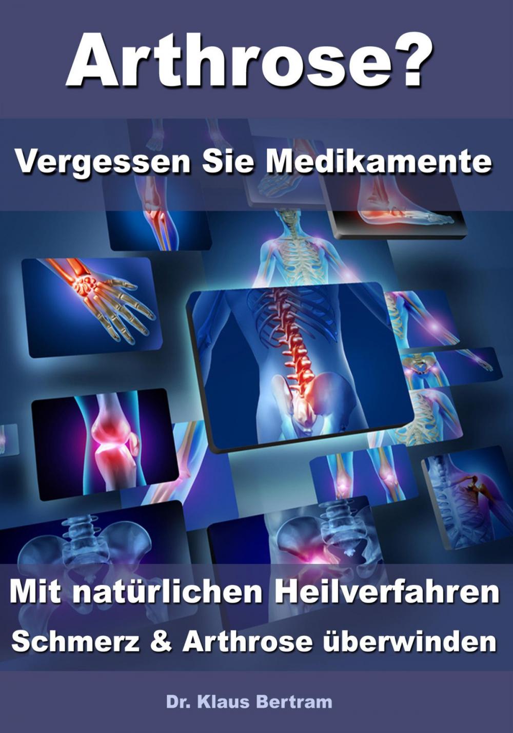 Big bigCover of Arthrose? – Vergessen Sie Medikamente – Mit natürlichen Heilverfahren Schmerz & Arthrose überwinden