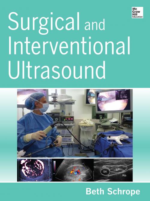 Cover of the book Surgical and Interventional Ultrasound by Beth Schrope, McGraw-Hill Education