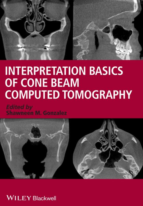 Cover of the book Interpretation Basics of Cone Beam Computed Tomography by Shawneen M. Gonzalez, Wiley