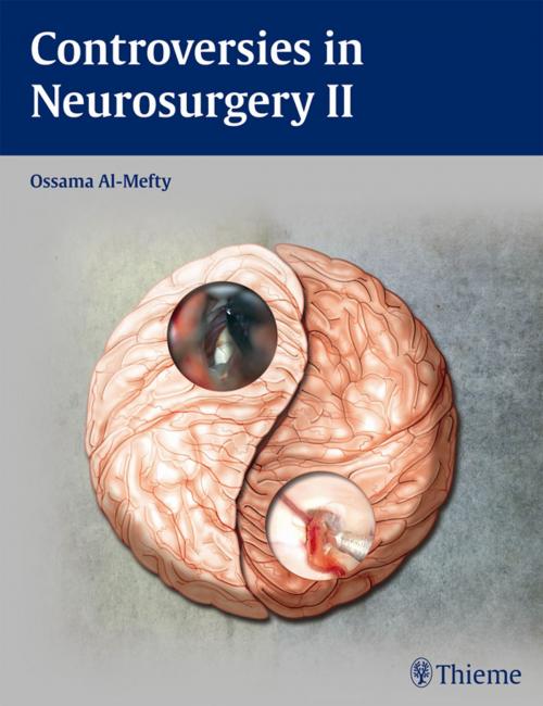Cover of the book Controversies in Neurosurgery II by , Thieme