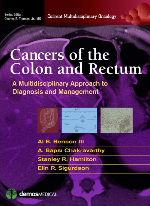 Cover of the book Cancers of the Colon and Rectum by Charles R. Thomas Jr., MD, Springer Publishing Company