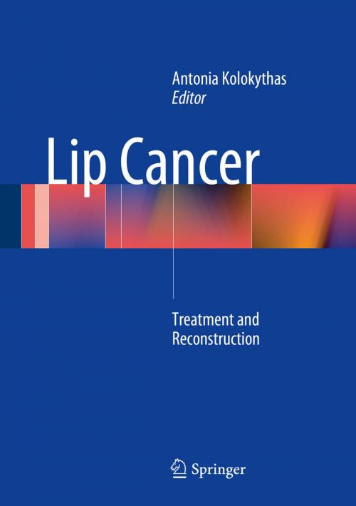 Cover of the book Lip Cancer by , Springer Berlin Heidelberg