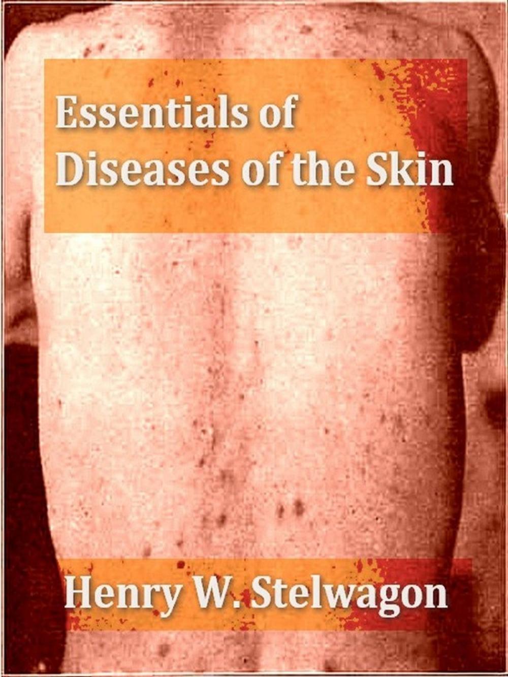 Big bigCover of Essentials of Diseases of the Skin, Seventh Edition