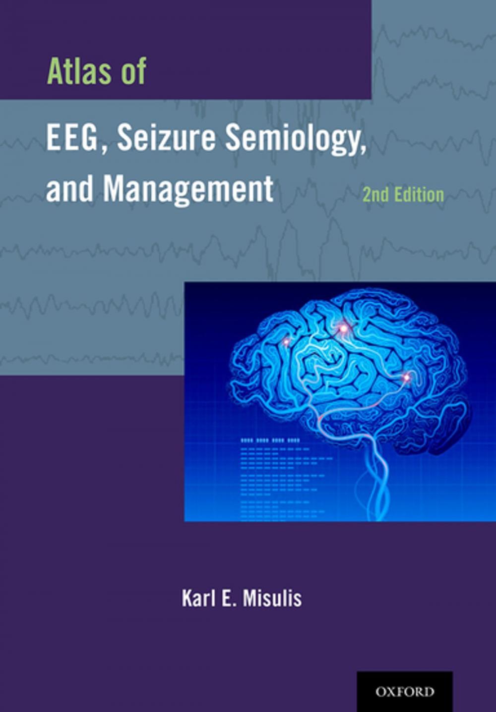 Big bigCover of Atlas of EEG, Seizure Semiology, and Management