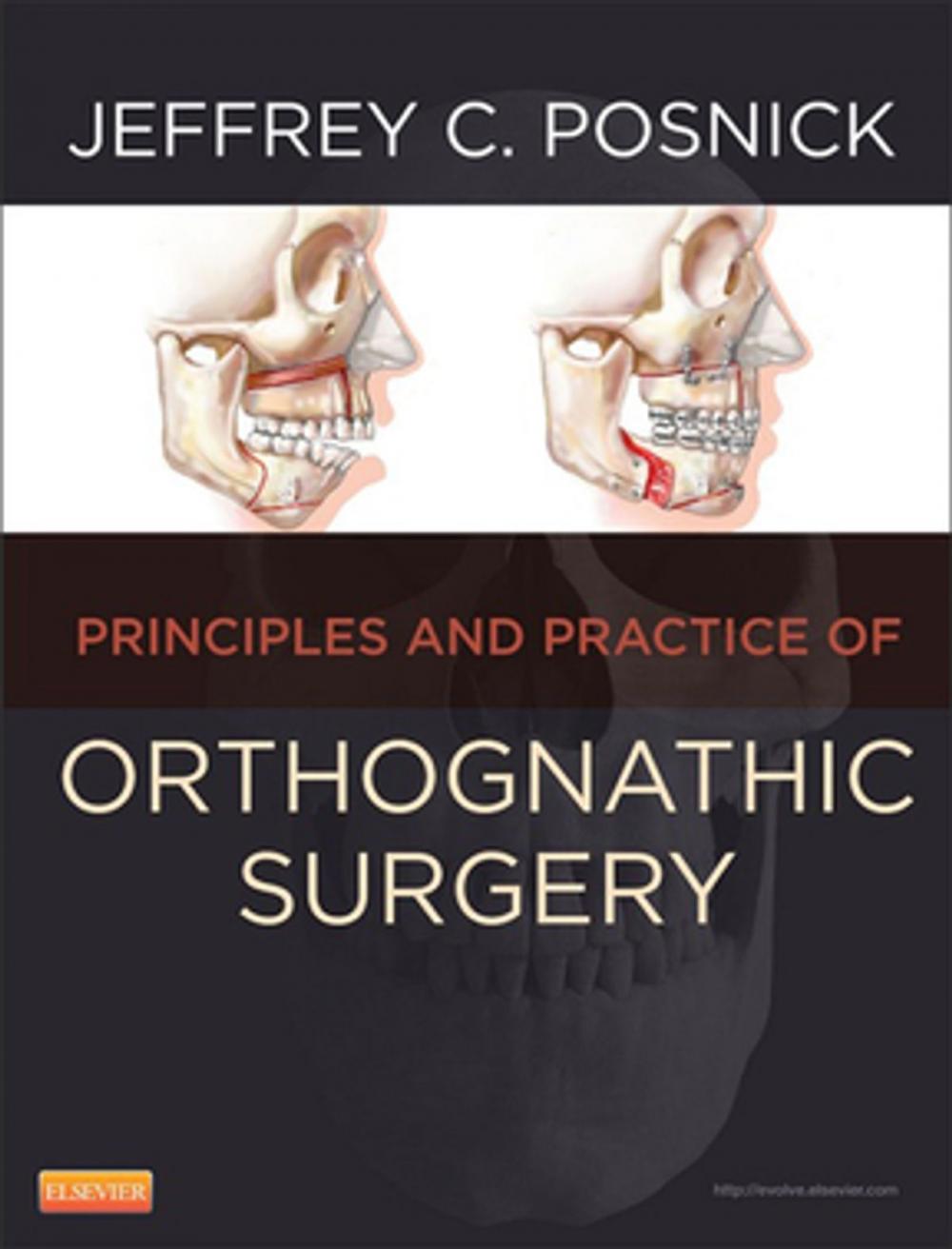 Big bigCover of Orthognathic Surgery - E-Book