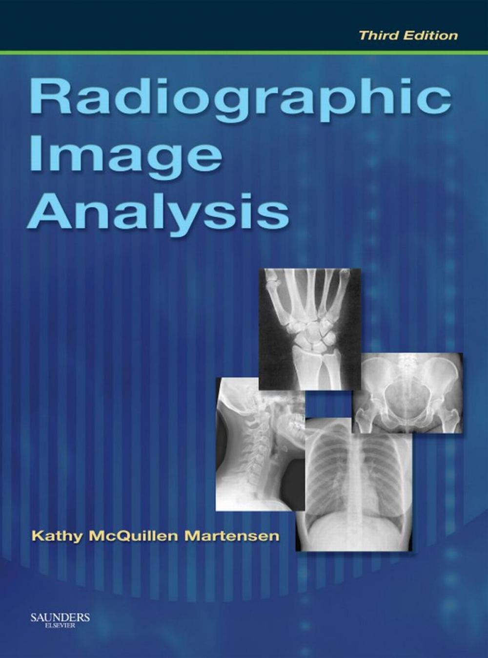 Big bigCover of Radiographic Image Analysis - E-Book