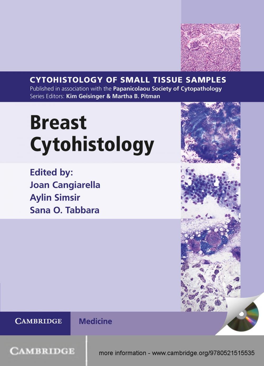 Big bigCover of Breast Cytohistology