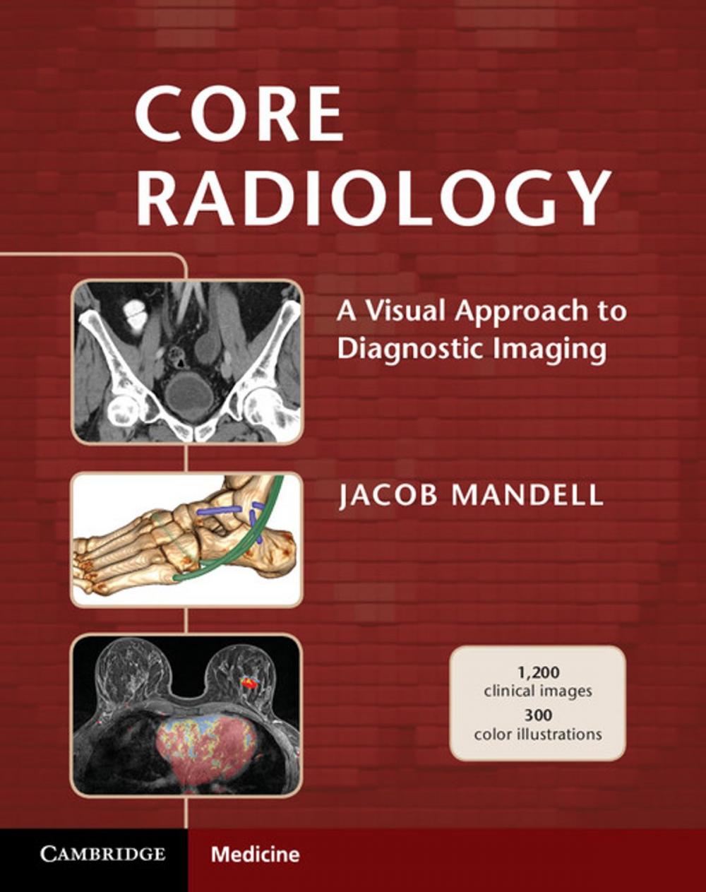 Big bigCover of Core Radiology