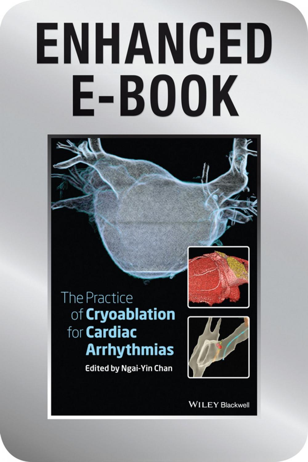 Big bigCover of The Practice of Catheter Cryoablation for Cardiac Arrhythmias, Enhanced Edition