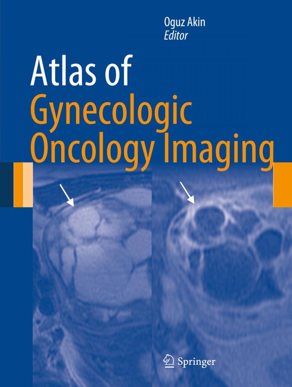 Big bigCover of Atlas of Gynecologic Oncology Imaging